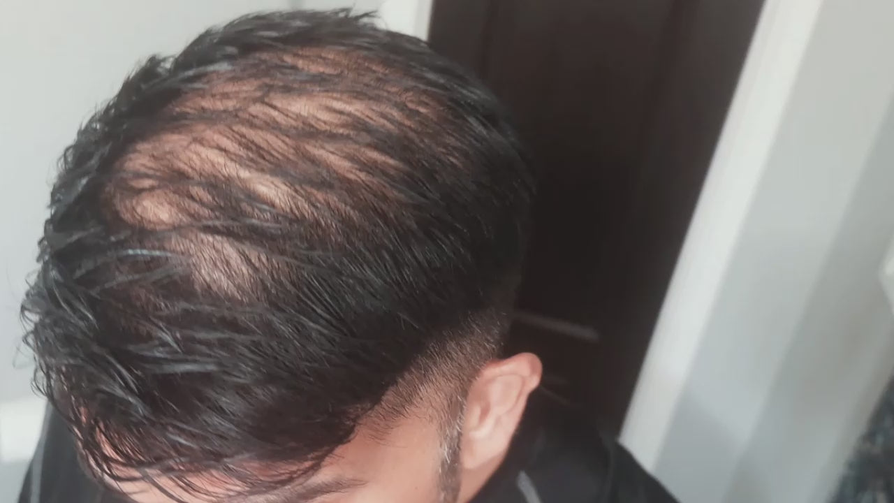 Load video: Use FULL&#39;R Hair Fibers to mark hair loss and get a full head of hair in 15 seconds